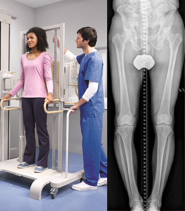 DigitalDiagnost