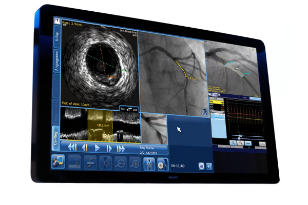 Новый раздел сайта: "Внутрисосудистые ультразвуковые исследования (ВСУЗИ)"