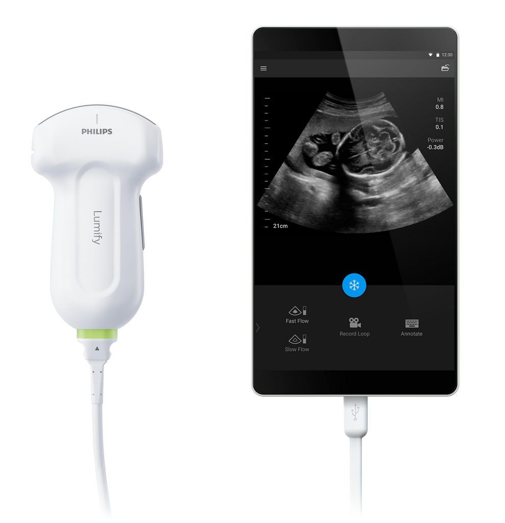 Philips LUMIFY