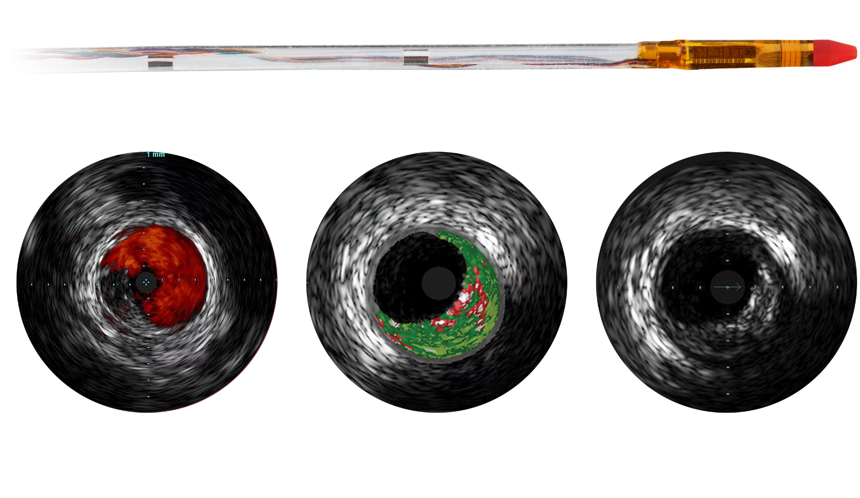 Eagle Eye Platinum ST